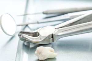 Extracted tooth next to dental instruments