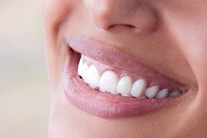Closeup of gorgeous smile after gum recontouring