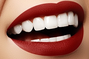 Woman’s beautiful teeth after visit to cosmetic dentist in Westborough