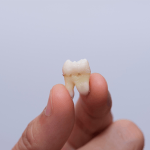 Close-up of extracted tooth between person’s thumb and forefinger