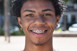 Young man with traditional braces smiling