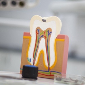 Model of a health tooth not in need of root canal therapy
