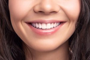 Close-up of woman’s beautiful smile after Invisalign or veneers