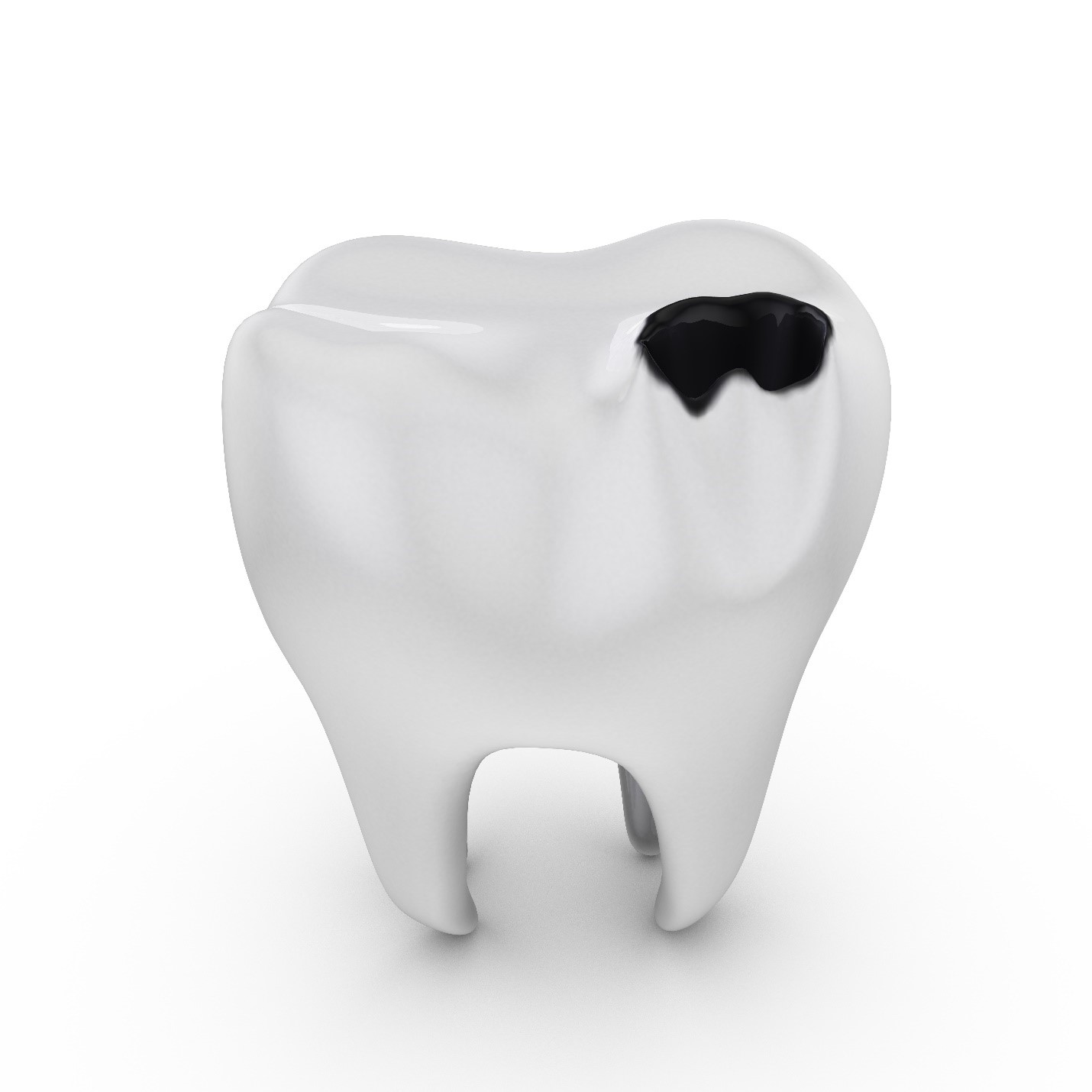 Cavities and Teeth Whitening: A Dangerous Combination - All Dental Cavities and Teeth Whitening: A Dangerous Combination - All Dental