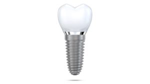 Single dental implant isolated against white background